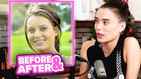 lana rhoades plastic surgery